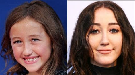 noah cyrus plastic surgery|What These Pop Stars Looked Like Before And After。